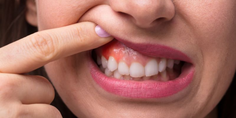 Why Do Your Gums Bleed?